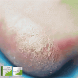 South Moon - 42% Urea Cream